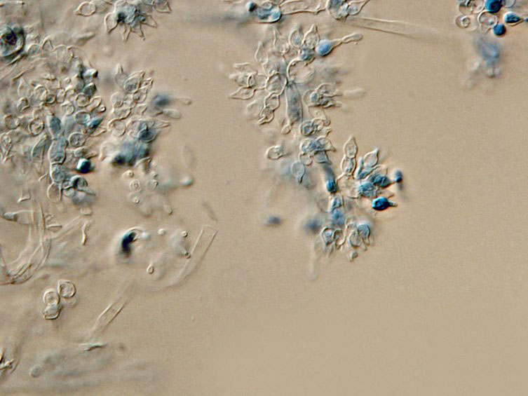 Cordyceps lepidopterorum